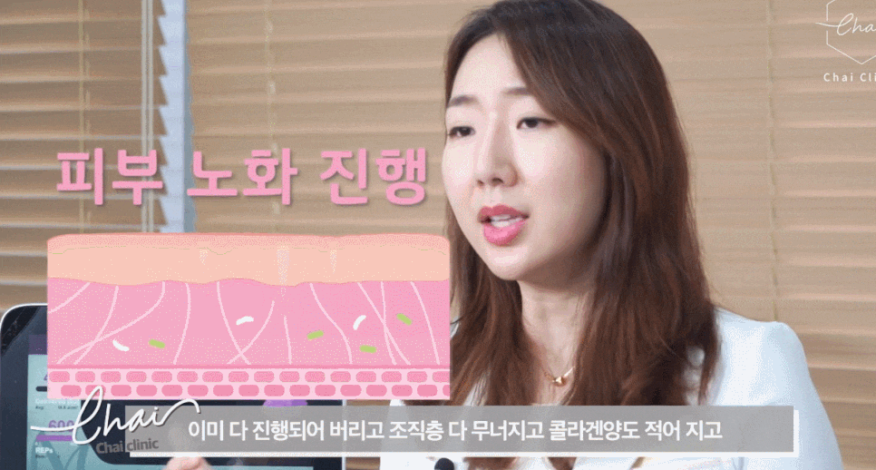 합정 써마지레이저 효과 없는 4가지 이유 관련 이미지 5