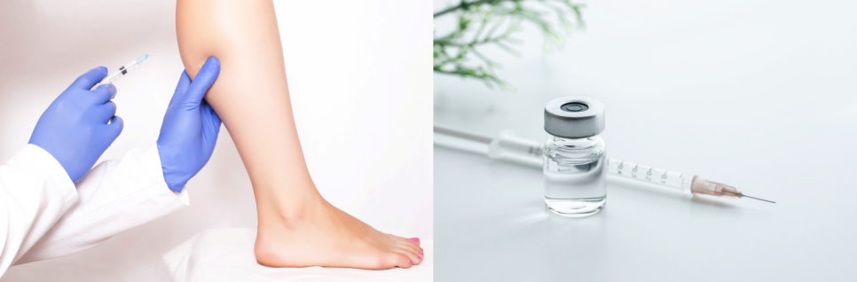종아리보톡스비용 여름철 무다리 콤플렉스 해결 관련 이미지 6