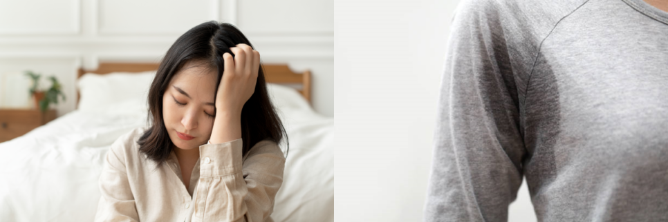 겨드랑이보톡스 다한증 치료에 효과적! 관련 이미지 4