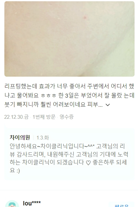 실리프팅 잘하는곳 찾으신다면 관련 이미지 9