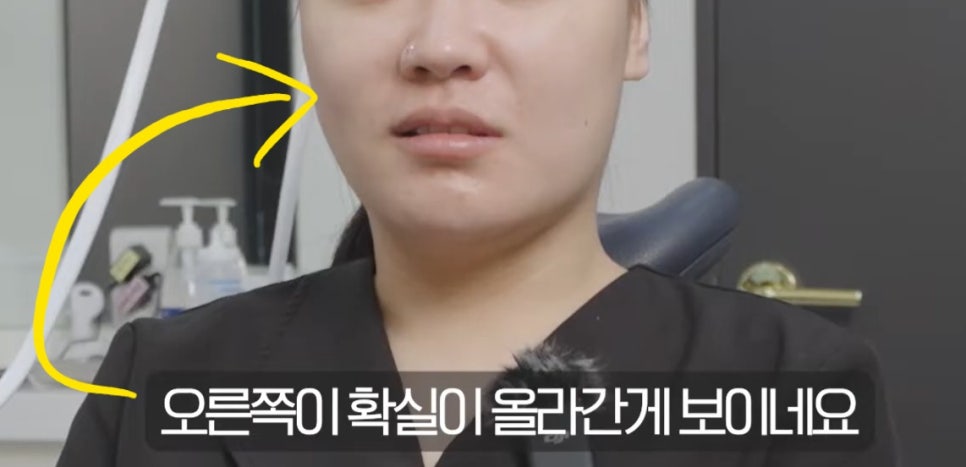 홍대 세르프 효과 올리는 방법 2가지 관련 이미지 5