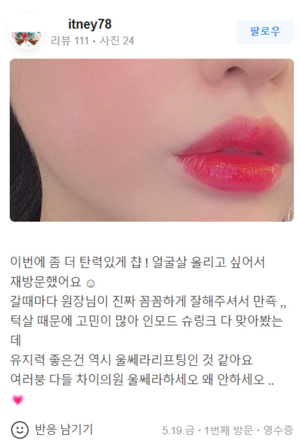 남자입술필러 자연스럽게 잘생겨지는 비결! 관련 이미지 7