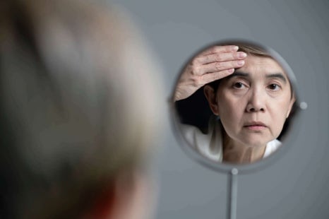 피부탄력 레이저, 탄력 잃은 피부를 탱탱하게 돌려드려요 관련 이미지 2