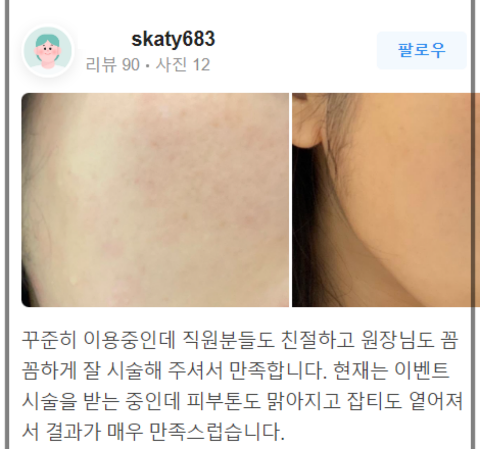 연어주사효과 리쥬란힐러에 대한 모든 것! 관련 이미지 9