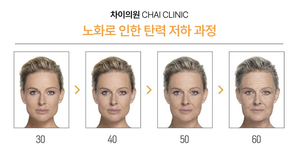 팔자주름 쥬베룩 볼륨의 유의미한 효과 관련 이미지 3