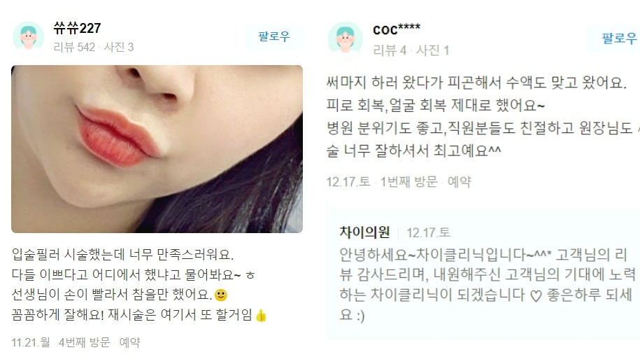 처진볼살리프팅 관련 이미지 16