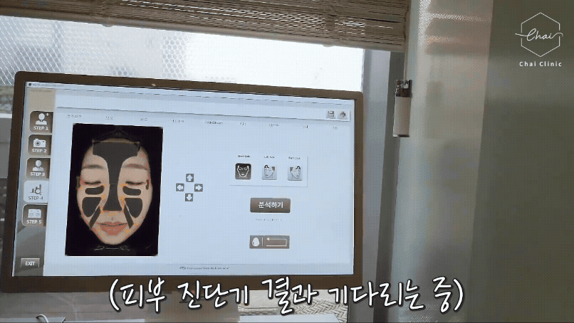 합정 리쥬란 효과 높이는 노하우 2가지 관련 이미지 4