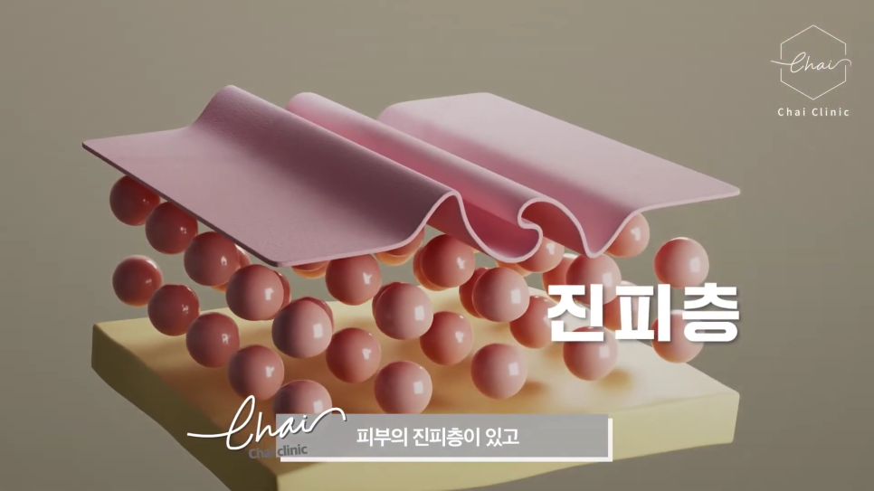 합정 써마지 30대&middot;40대&middot;50대 연령별로 달라지는 디자인 관련 이미지 6