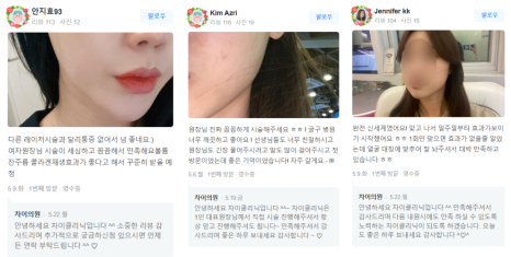 울쎄라팔자주름 울쎄라 실력자가 강조하는 &lsquo;이것&rsquo;! 관련 이미지 16