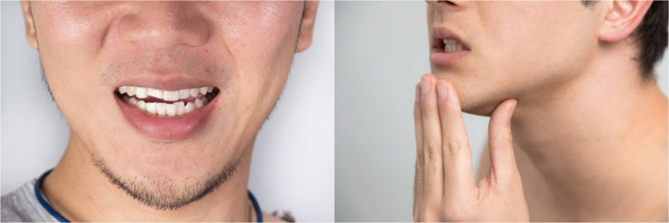 남자무턱필러로 얼굴라인 매끈하게 개선! 관련 이미지 5