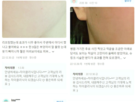 기미 레이저토닝 높은 효과는 OO에서 차이납니다. 관련 이미지 23