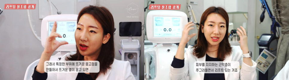 슈링크와 슈링크유니버스 효과 차이 딱 정리해 드립니다! 관련 이미지 8