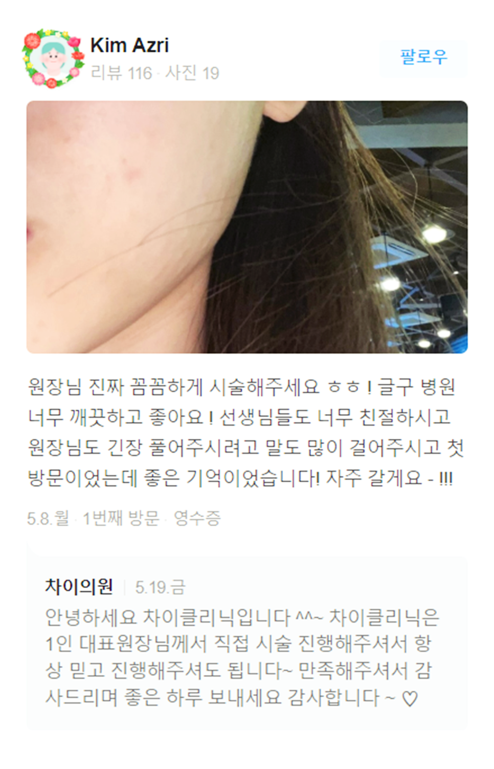 아이슈링크 눈가 주름 없는 동안 피부로 관련 이미지 19