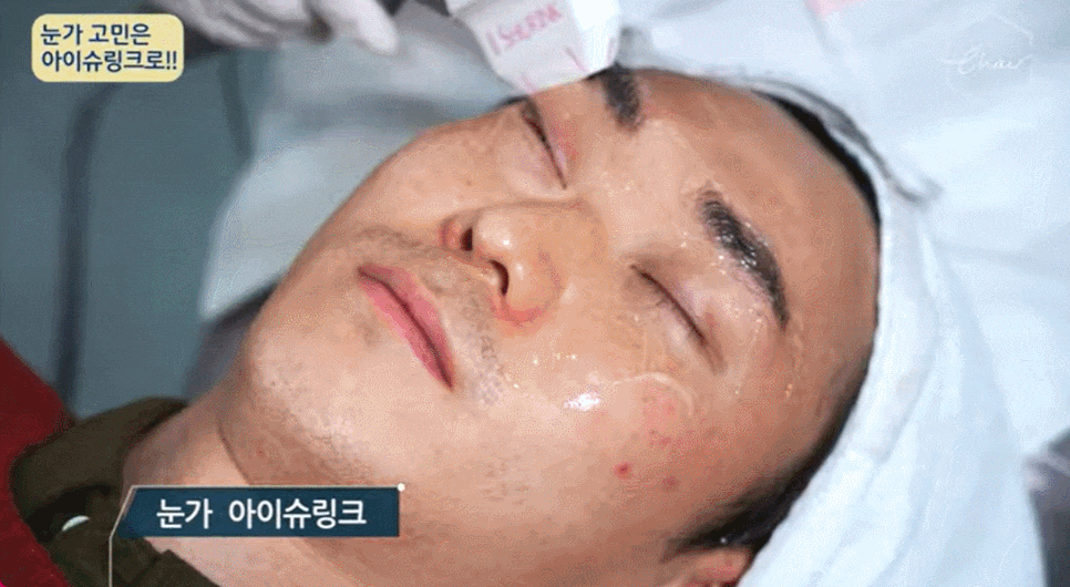 눈밑처짐수술, 수술없이 실리프팅 가능해요 관련 이미지 6