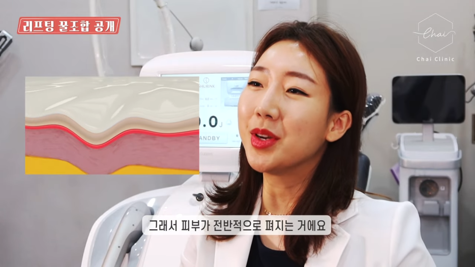 상수 리프팅 나에게 맞는 방법을 찾고 싶다면 관련 이미지 5