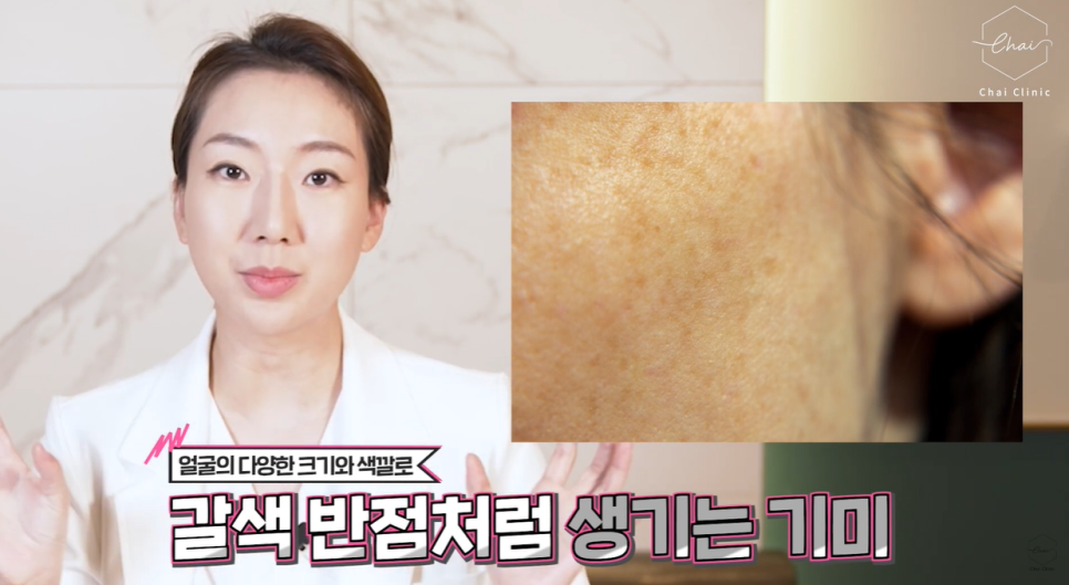 If You Don’t Want to Waste Money on Hongdae Pico Toning, Look at These 3 Things image 3