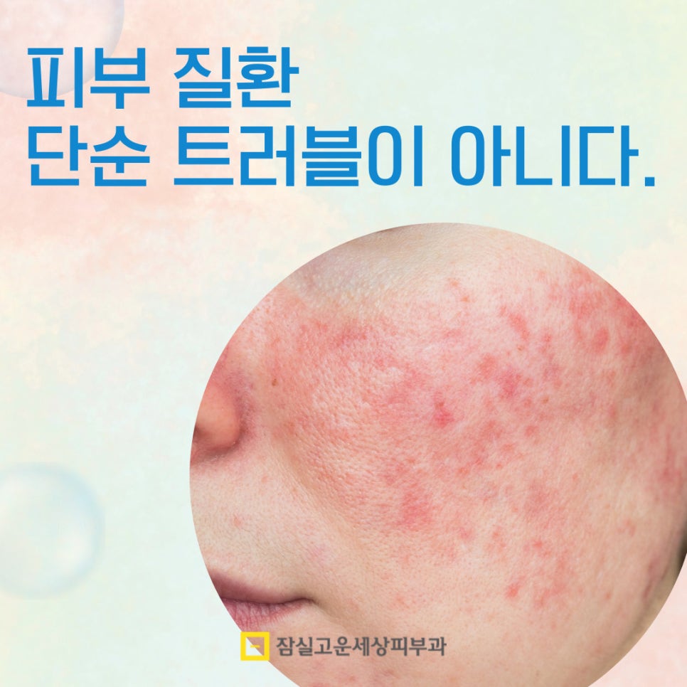피부질환, 단순 트러블이 아닙니다. 관련 이미지 1