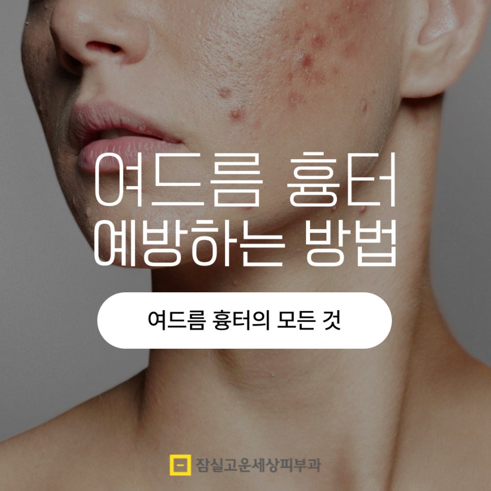 여드름, 왜 흉터로 남을까? 그리고 어떻게 예방할까? 관련 이미지 1