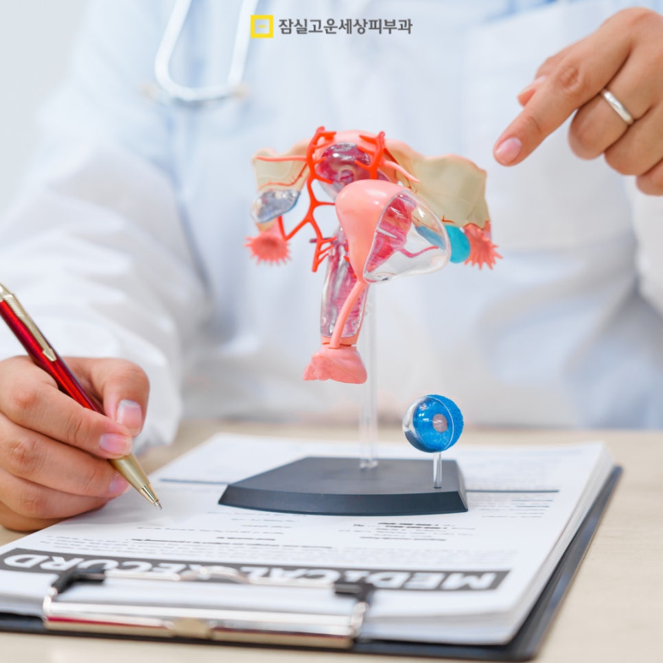 여드름 Q&A, 주요 궁금증들 관련 이미지 3