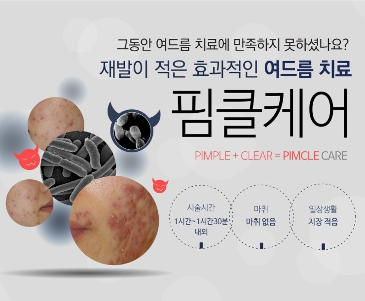 피지 폭발하는 여름, 화농성여드름 치료는 잠실여드름피부과에서! (잠실고운세상피부과/잠실역근처피부과/잠실여드름/핌클케어) 관련 이미지 6