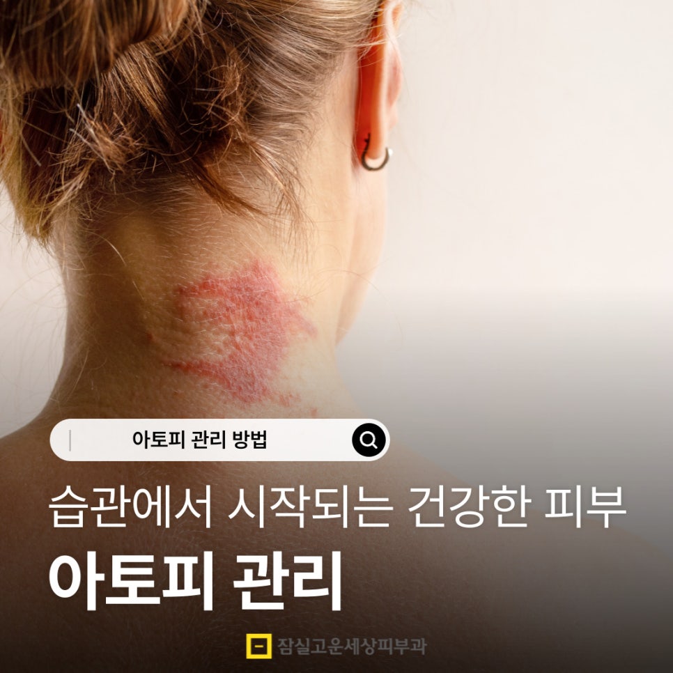 아토피 관리, 습관에서 시작되는 건강한 피부 관련 이미지 1