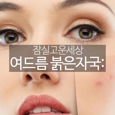 잠실여드름치료 여드름붉은자국도 없앨 수 있나요? (잠실역피부과/여드름흉터제거/여드름자국레이저/브이빔레이저) 관련 이미지 5