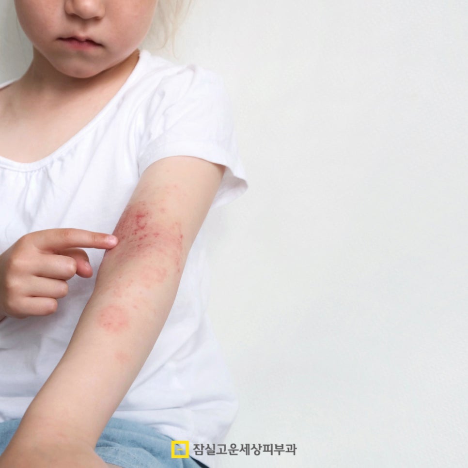 아토피 관리, 습관에서 시작되는 건강한 피부 관련 이미지 4