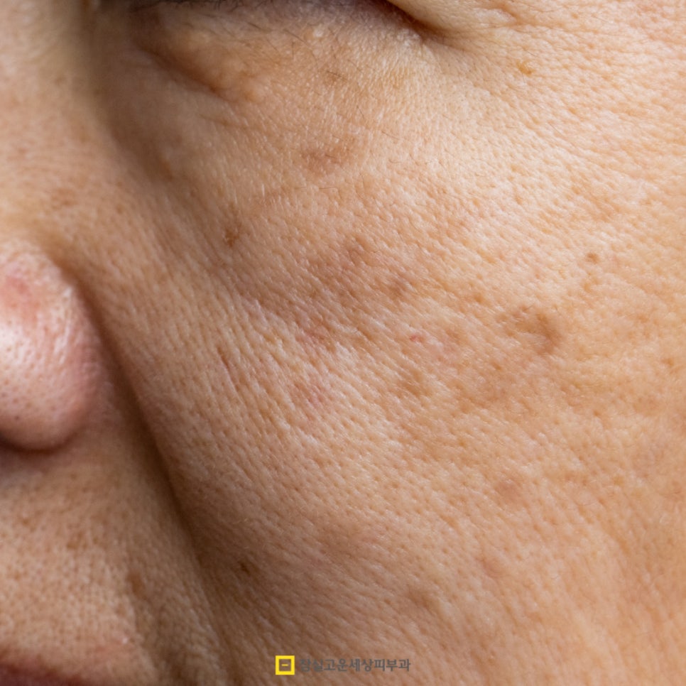 '기미, 주근깨, 잡티' 한번에 잡는 미백 식습관 & 관리법 관련 이미지 4