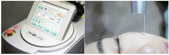 피부나이측정 집에서 하기! 2016 새해 피부나이 이제 그만 먹자! 관련 이미지 8