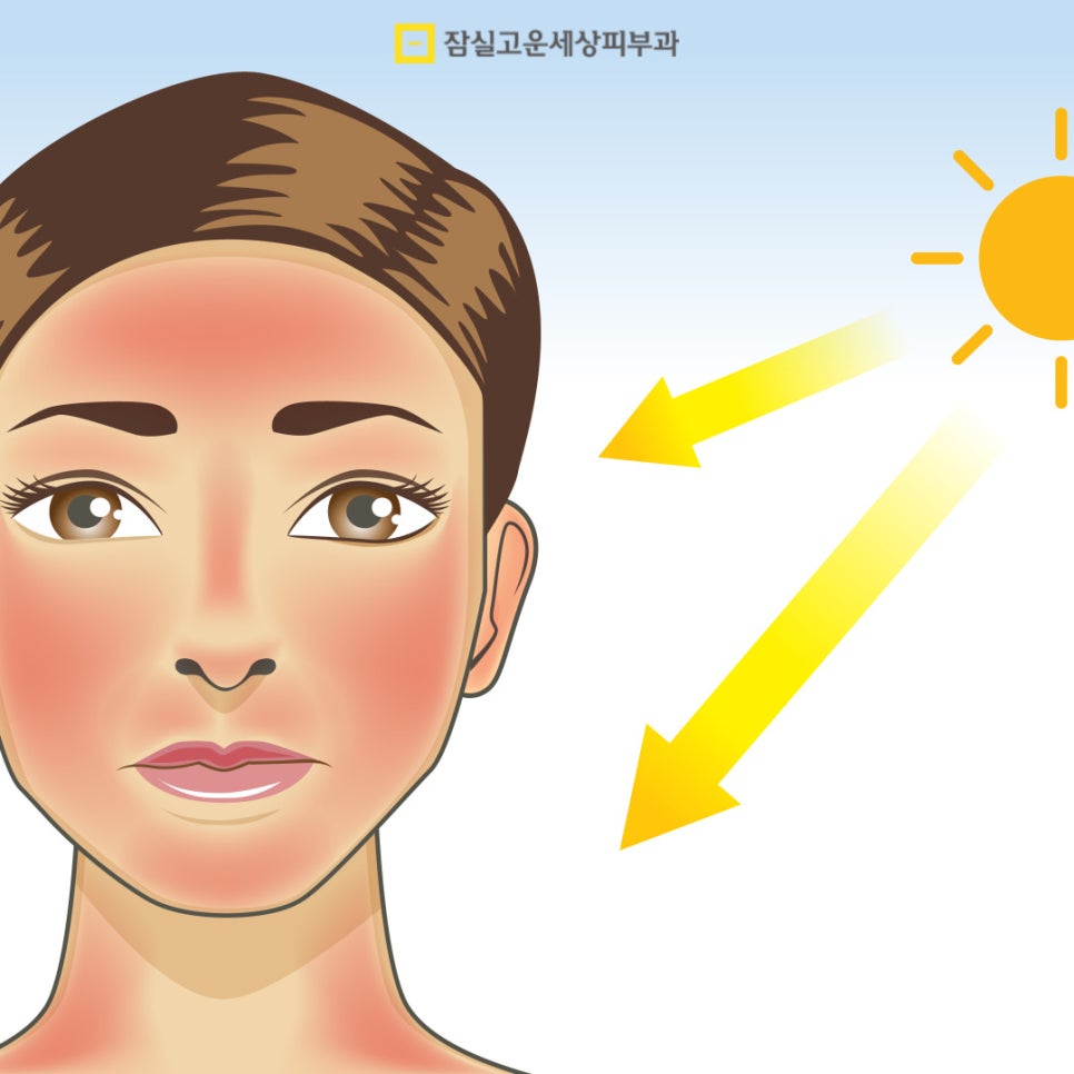안면홍조, 왜 사라졌다가 다시 심해질까? 관련 이미지 3