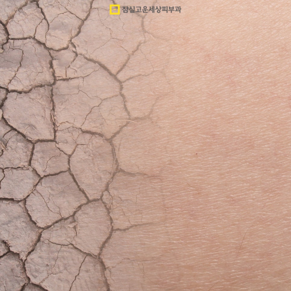 [잠실고운세상피부과] 피부관리 가이드, 기초부터 고급까지! 관련 이미지 2