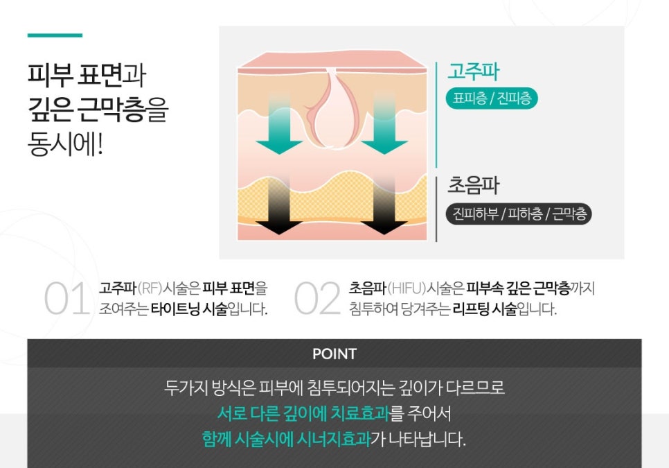 잠실고운세상 J리프팅 프로그램 관련 이미지 2