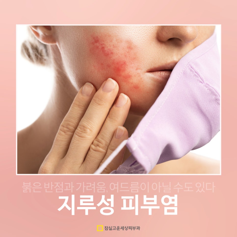 가려움, 홍조까지 부르는 지루피부염, 답은 여기에 있다. 관련 이미지 1