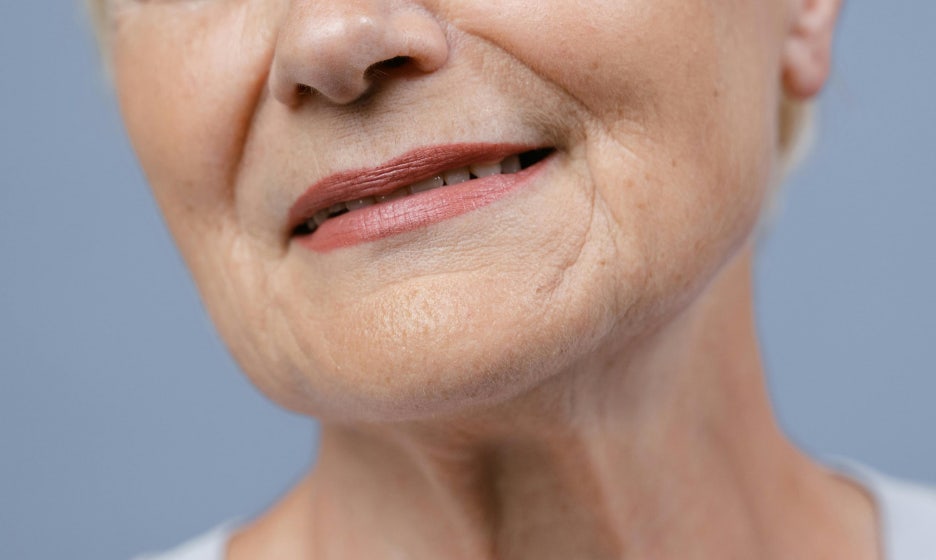 나이 들어 보이는 얼굴, 피부가 아닌 안면근육 변화일 수 있습니다 &ndash; 엠페이스 리프팅의 원리 관련 이미지 4