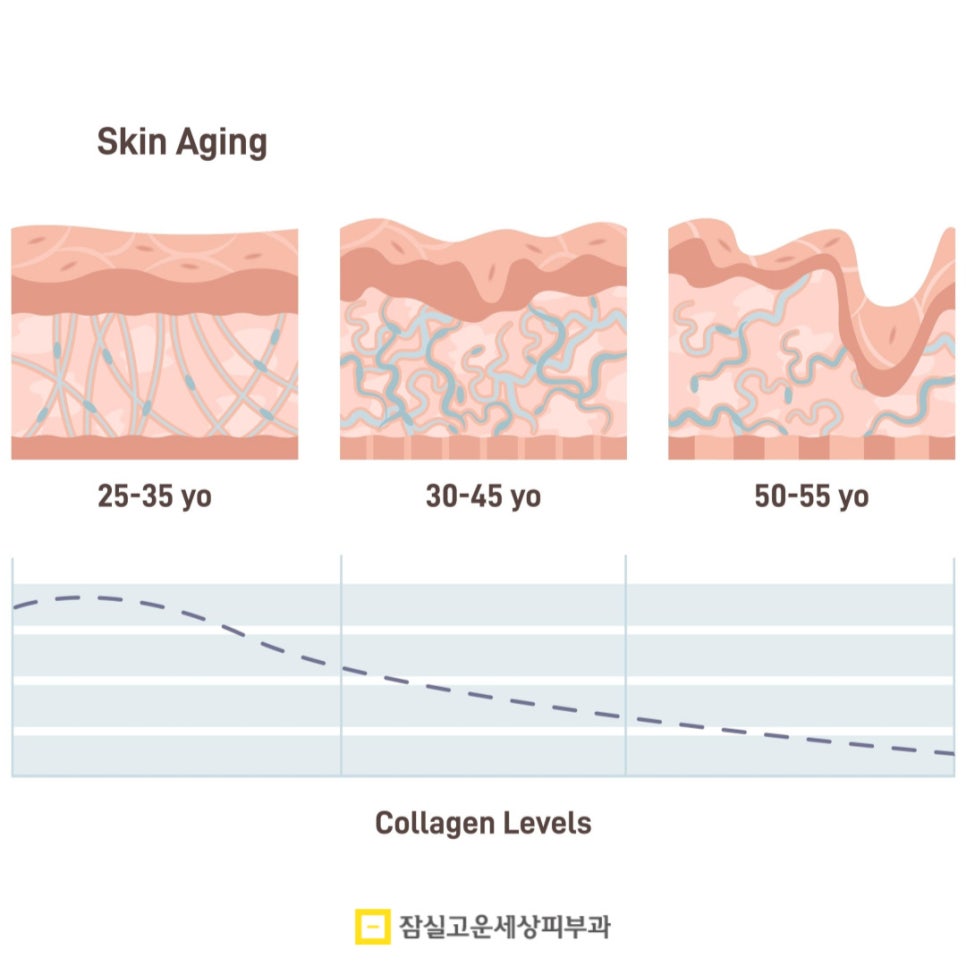 고주파 리프팅, 언제 받는게 가장 효과적일까? 관련 이미지 4