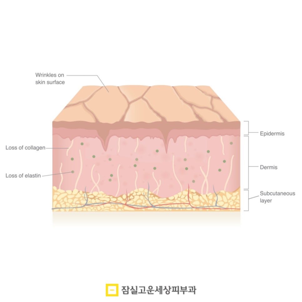 환절기 피부 고민, 딱 1가지 시술만 받는다면? 관련 이미지 5
