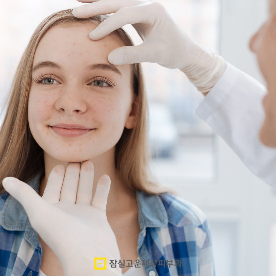 우리 아이 사춘기 여드름, 언제부터 어떻게 관리해야 할까? 관련 이미지 5