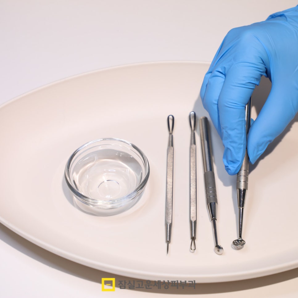 여드름 압출, 왜 해야 하고 어떻게 해야 안전할까? 관련 이미지 5