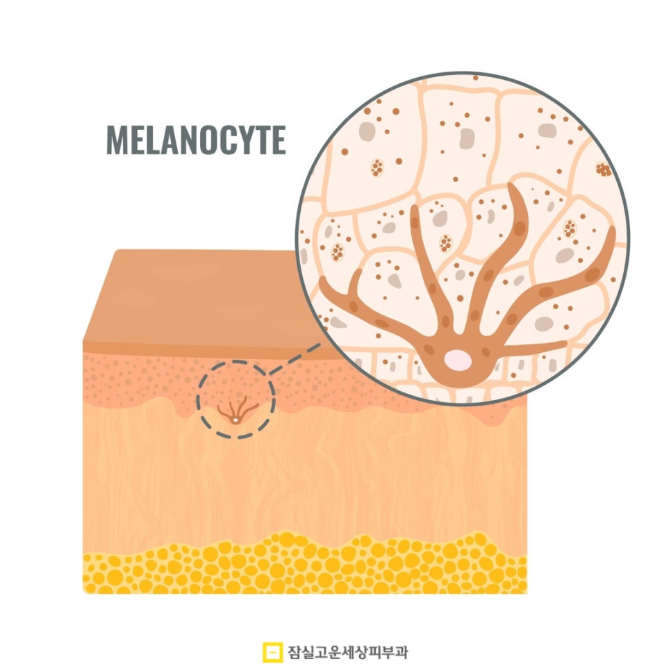 한여름, 기미 관리의 핵심은 관련 이미지 8