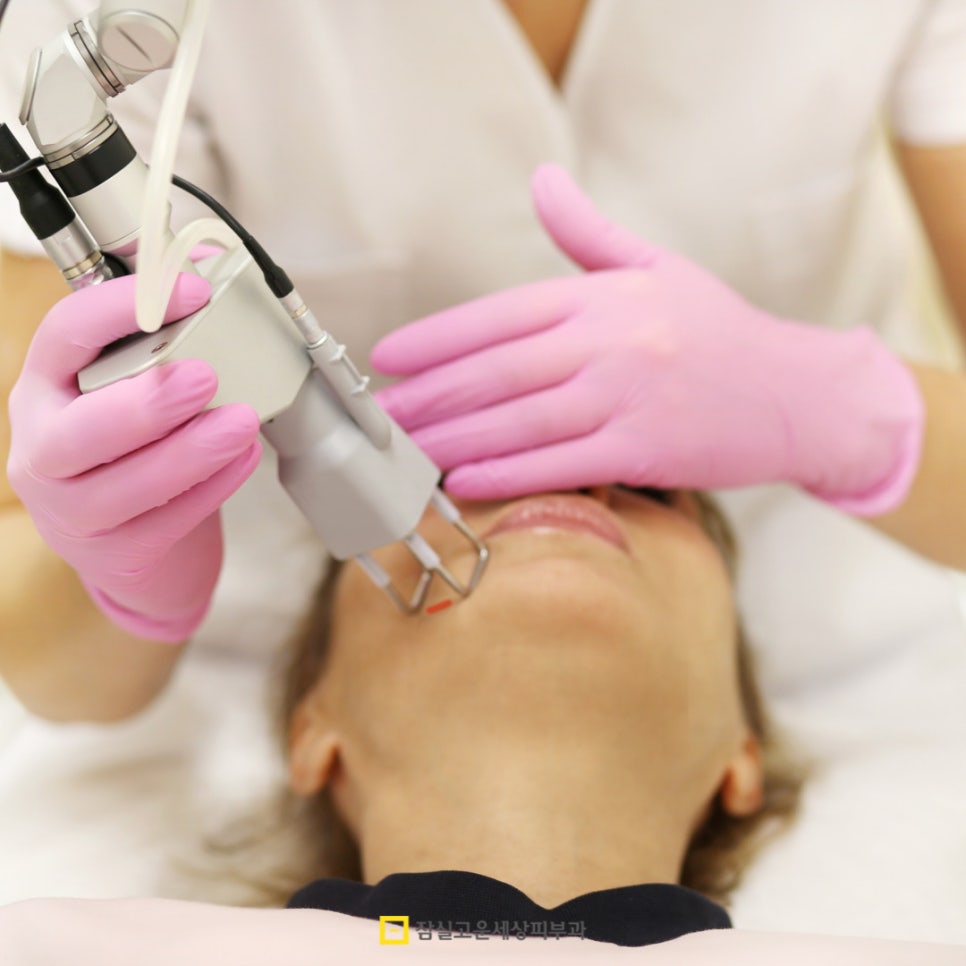 여드름 레이저 치료, 어떻게 작용하고 몇 번 받아야 할까? 관련 이미지 2