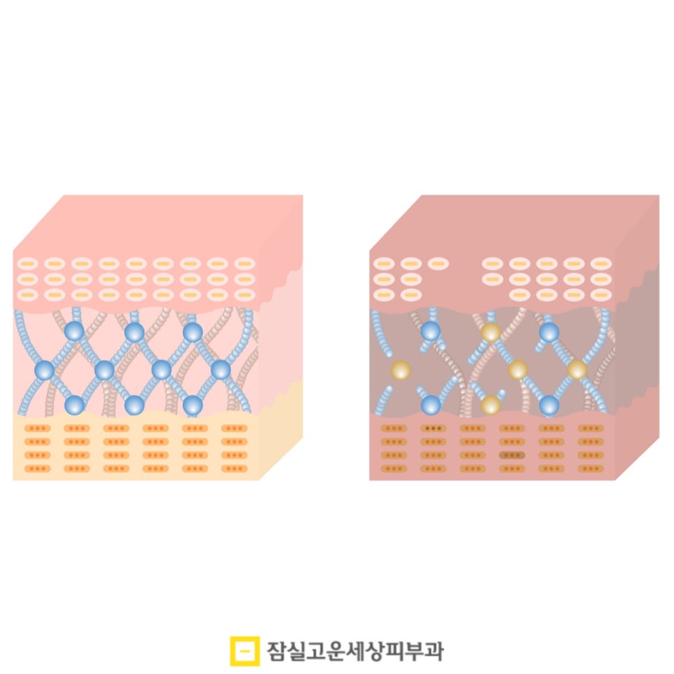 환절기 피부 고민, 결국 답은 속부터 채우는 것 관련 이미지 3