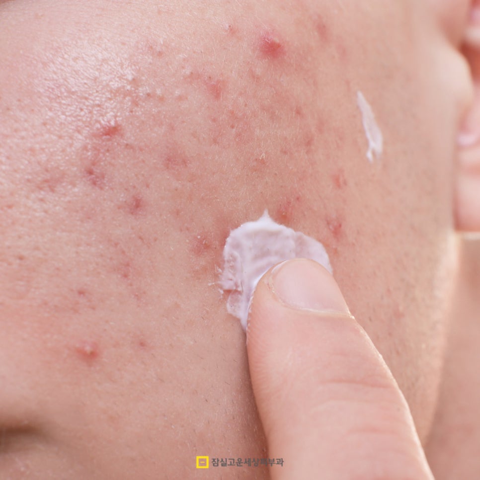 10대 올바른 피부관리, 메이크업도 안전하게 관련 이미지 5