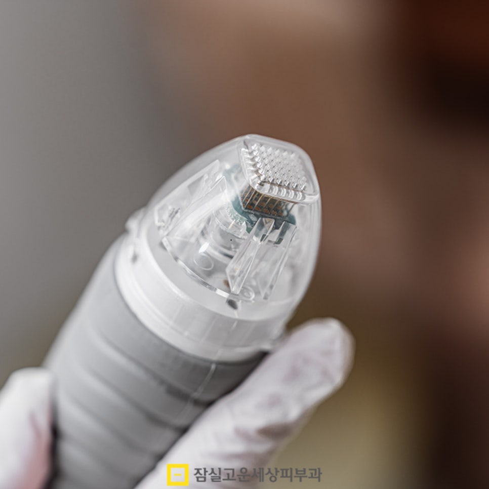 피부과 여드름 치료, 실펌 엑스가 주목받는 이유 관련 이미지 7