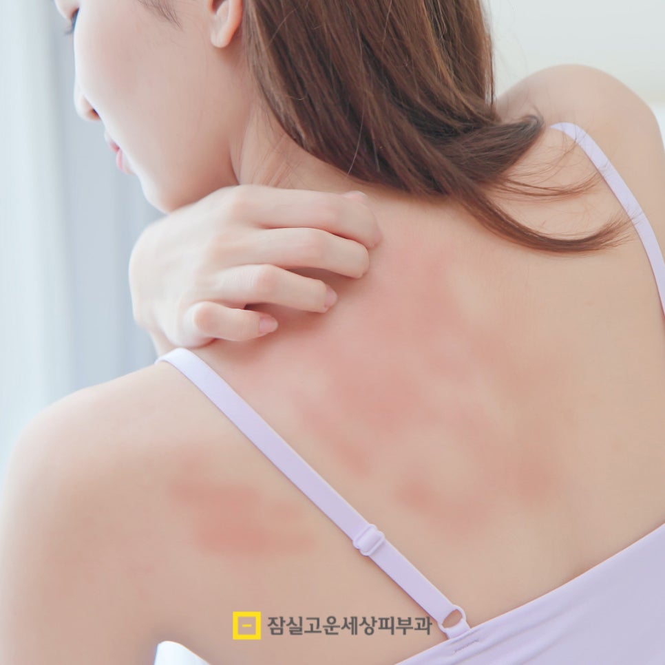 피부질환, 단순 트러블이 아닙니다. 관련 이미지 3