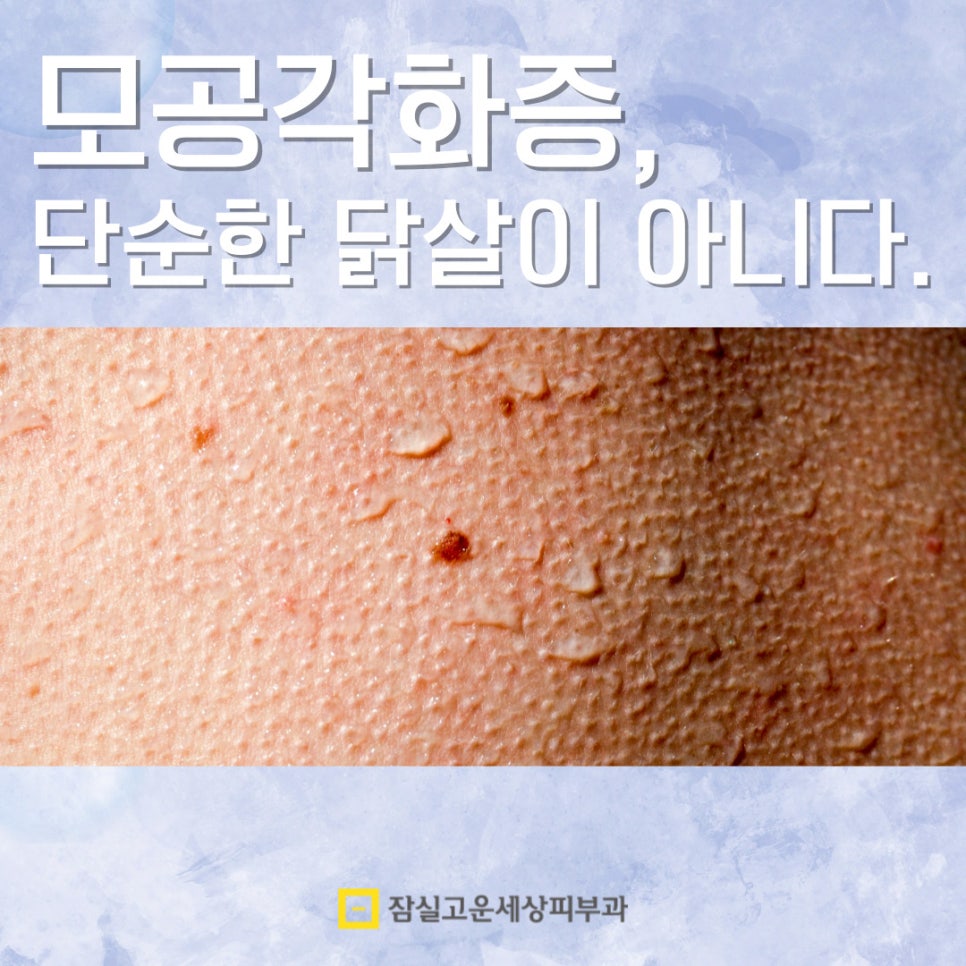 모공각화증, 단순한 관련 이미지 1