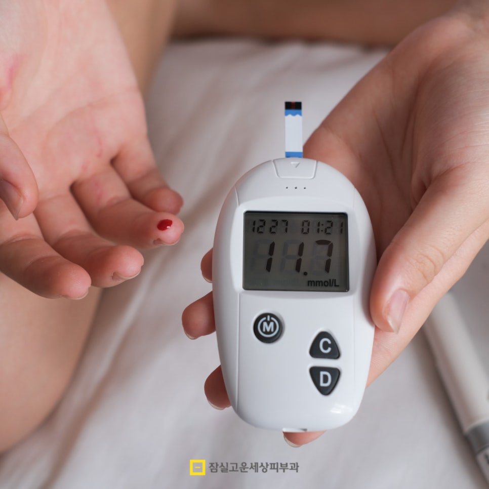 여드름 관리 식단, &lsquo;피해야 할 음식 vs 권장할 음식&rsquo; 관련 이미지 3