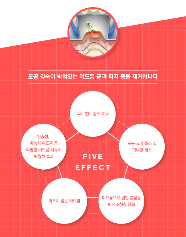 봄꽃축제 시즌, 꽃가루알레르기 피부염 조심하세요! (잠실고운세상피부과) 관련 이미지 7