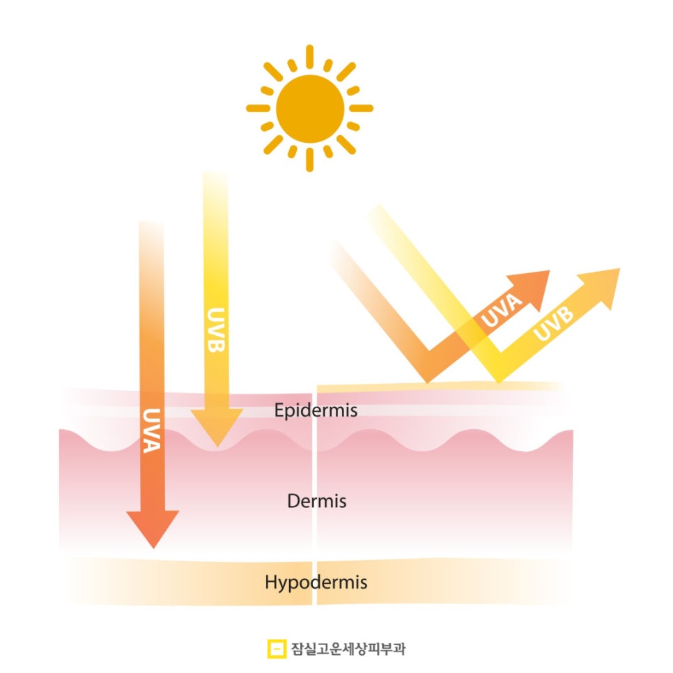여름철, 피부탄력을 지키는 7가지 전략 관련 이미지 3
