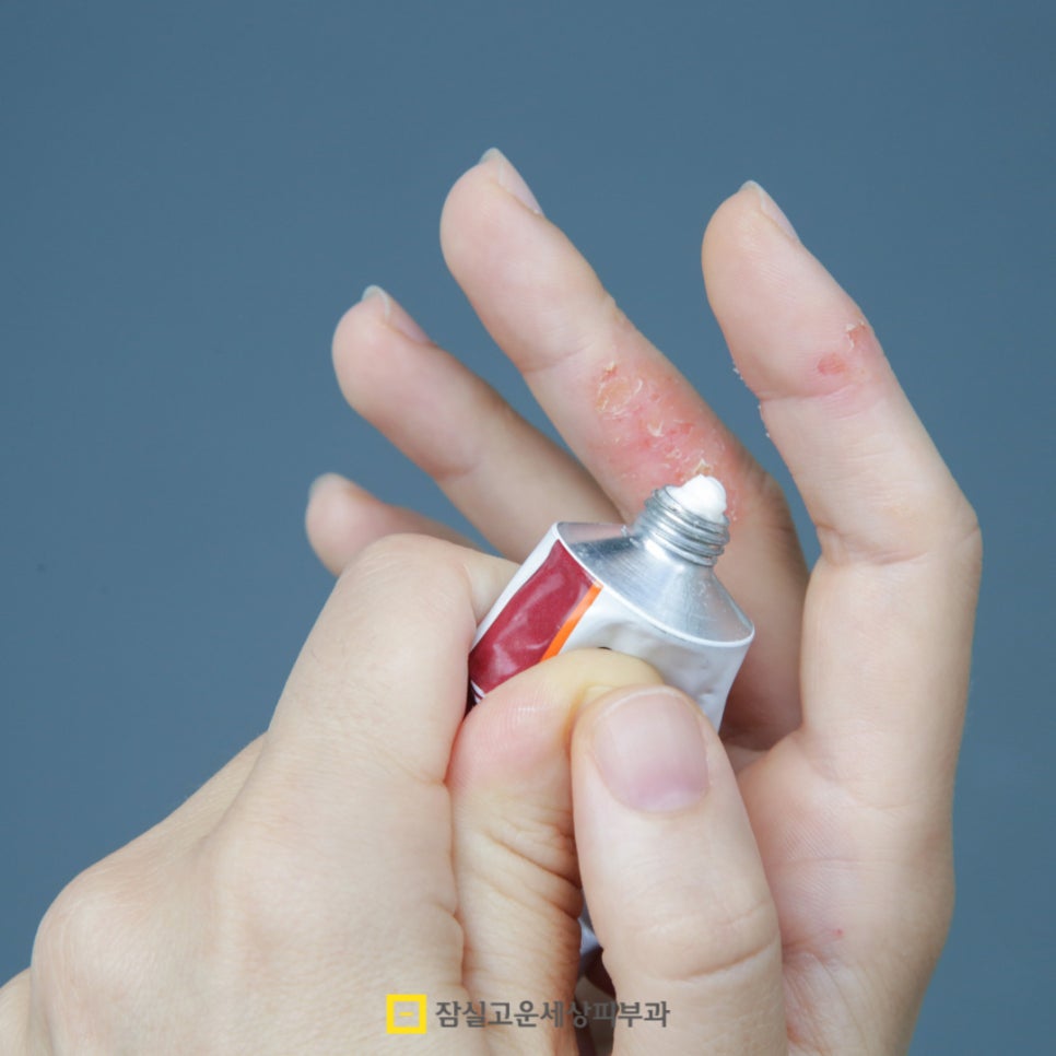 아토피 관리, 습관에서 시작되는 건강한 피부 관련 이미지 7