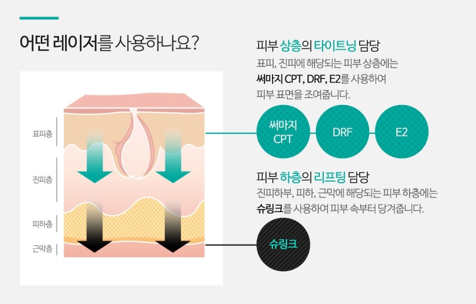 잠실고운세상 J리프팅 프로그램 관련 이미지 3